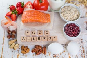 Level 2 Food Allergen Awareness. Image of a selection of allergen foods with the lettering "FOOD ALLERGY".